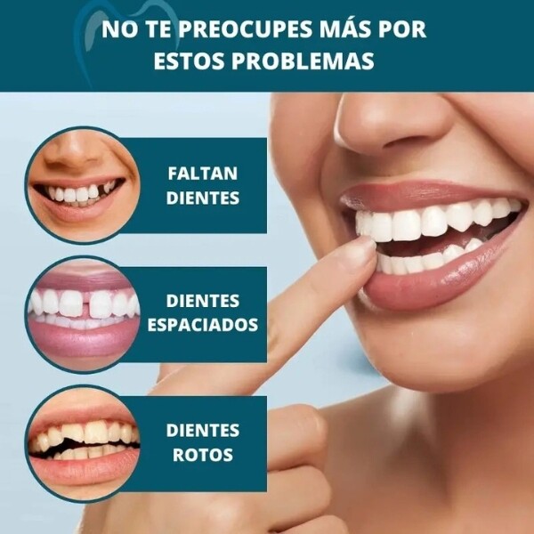 SONRISA PERFECTA - CARILLAS DENTALES INFERIORES Y SUPERIORES