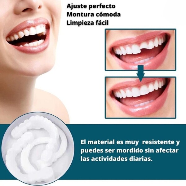 SONRISA PERFECTA - CARILLAS DENTALES INFERIORES Y SUPERIORES